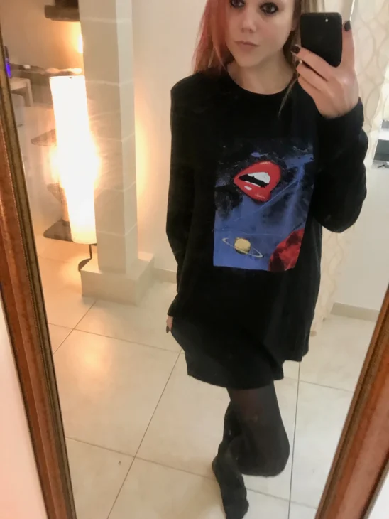 Black Lips Printed Oversized T-Shirt Dress